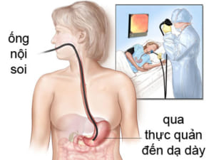 nội soi dạ dày tại trung tâm y tế huyện Quế Phong